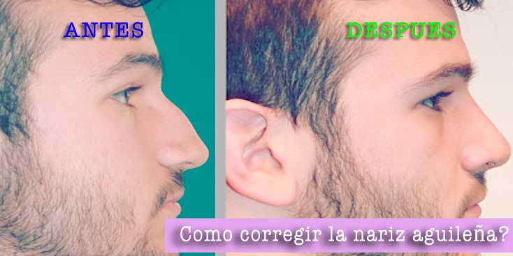 CORRECCION pre y post