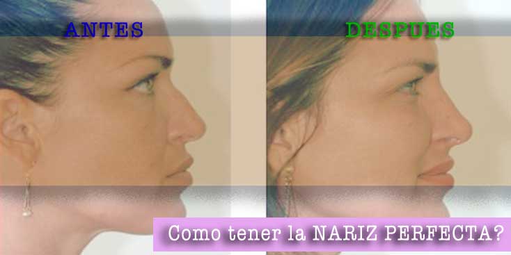 La nariz perfecta